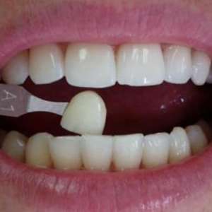 234ec57208259b2f8085e33fb2396d04.jpg
184315
jpg